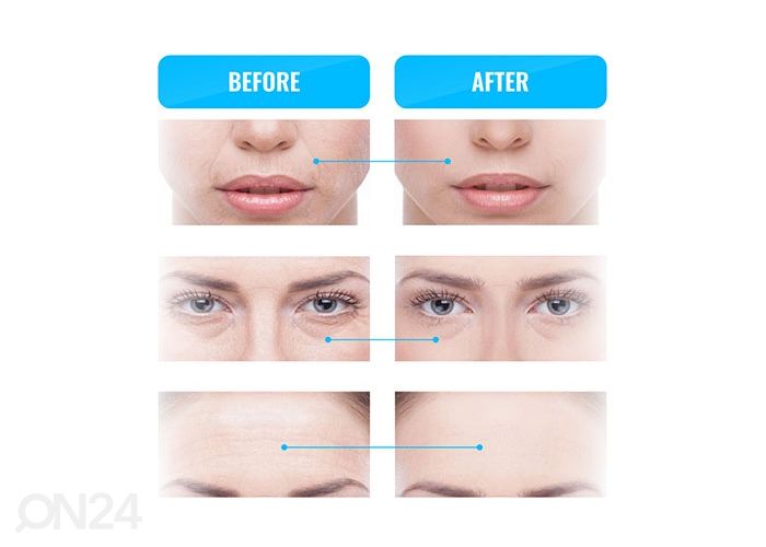 Массажер для лица с микротоковой терапией GESS MT увеличить