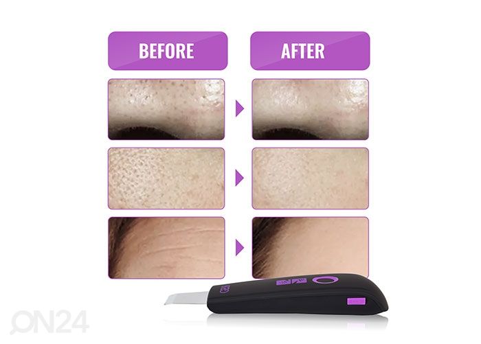 Аппарат ультразвуковой для чистки лица Skin Scrubber, GESS YOU увеличить